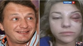 Марат Башаров жестоко избил жену, сломав ей нос